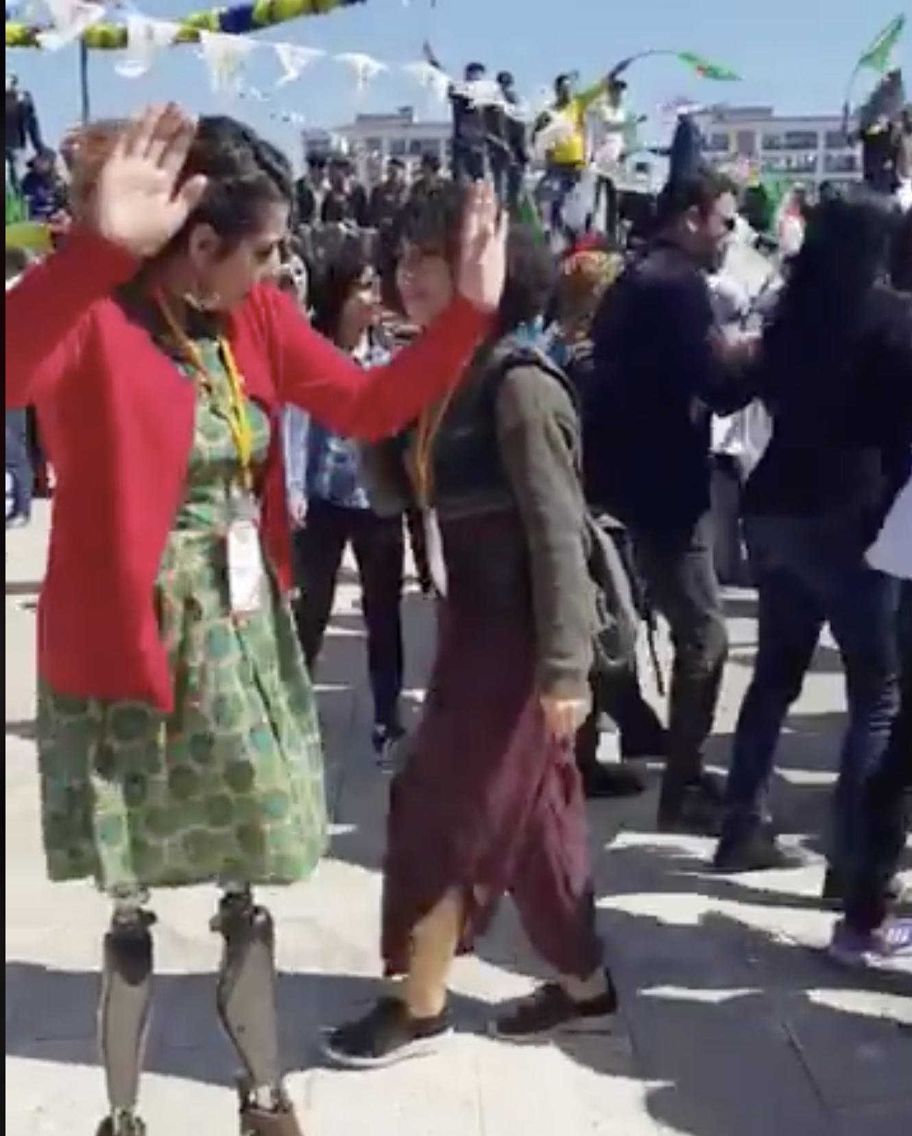 ΗΡΩΪ́ΔΑ! Η Κούρδισσα που έχασε και τα δυο της πόδια από τους ισλαμοφασίστες, είναι όρθια και δίνει μάθημα αγώνα και ζωής.