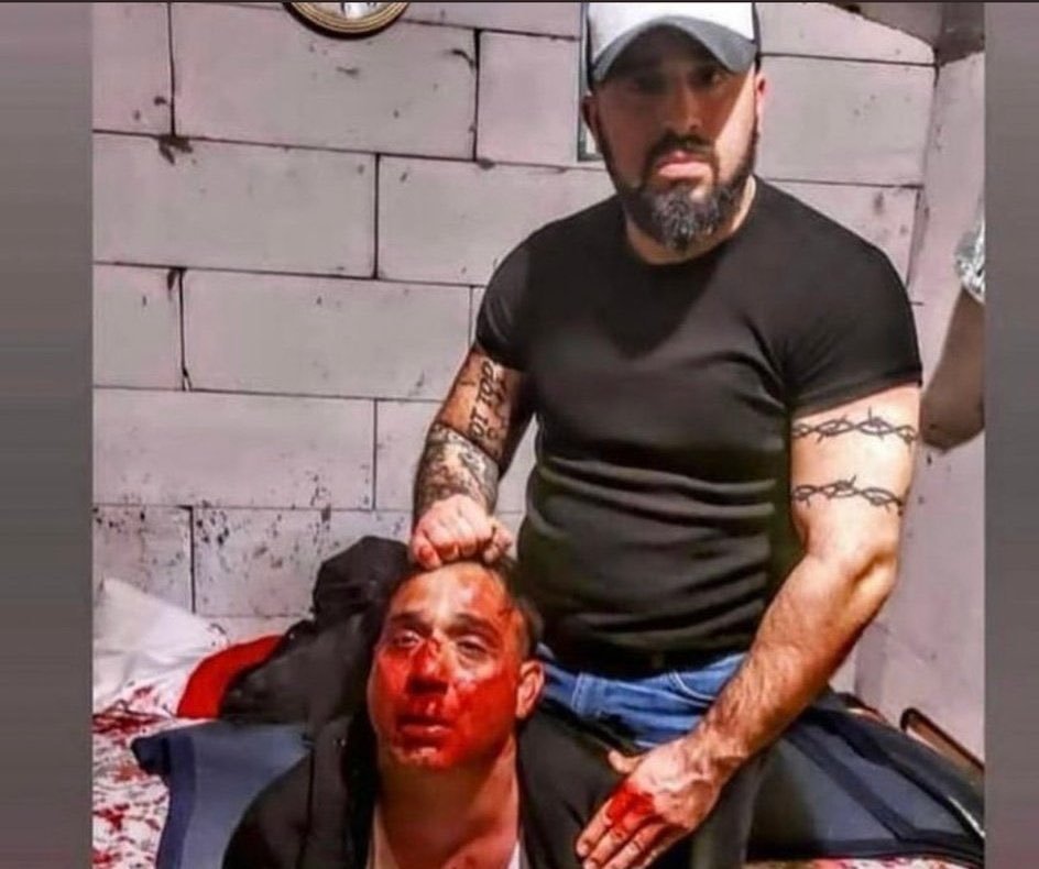 Φρικτά βίντεο από την δράση του τούρκου που βασάνιζε ομοφυλόφιλους, ανάπηρους και γυναίκες! 8 63280667 8B06 4CBD 854F 617F781D387B