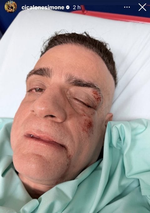 Ιταλία: Ο Youtuber Cicalone Simone, ξυλοκοπήθηκε άγρια από μετανάστες που ληστεύουν τουρίστες στη Ρώμη 6 IMG 8728