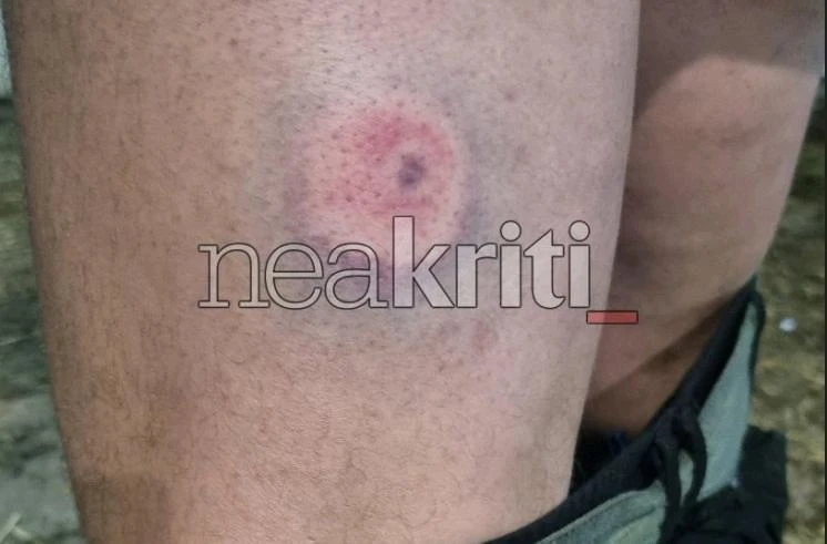 Κρήτη: Πάνω από δέκα αγρότες και κτηνοτρόφοι τραυματίστηκαν από πλαστικές σφαίρες που φέρεται να εκτόξευσαν οι αστυνομικές δυνάμεις 8 IMG 9941