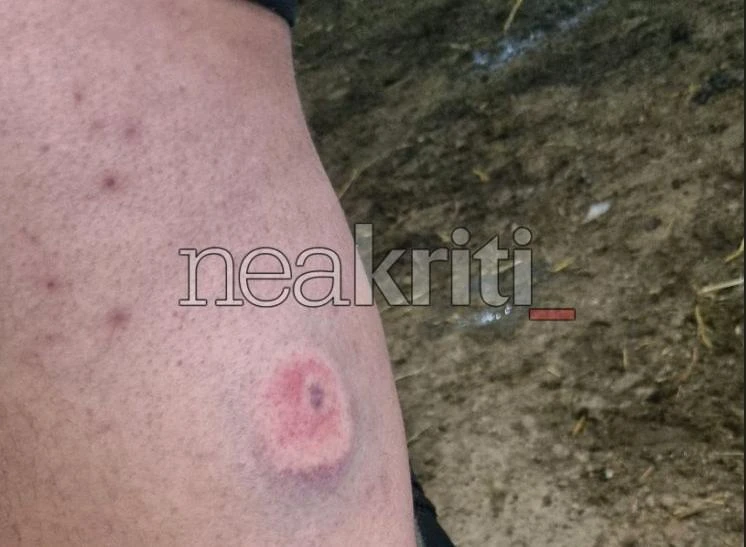 Κρήτη: Πάνω από δέκα αγρότες και κτηνοτρόφοι τραυματίστηκαν από πλαστικές σφαίρες που φέρεται να εκτόξευσαν οι αστυνομικές δυνάμεις 10 IMG 9943