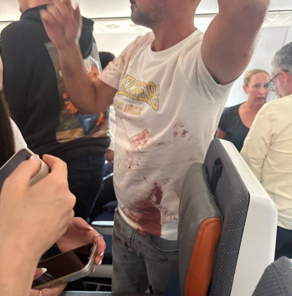 Ισραηλινός επιβάτης μέσα στα αίματα αποκαλύπτει ότι έγινε τρομοκρατική επίθεση